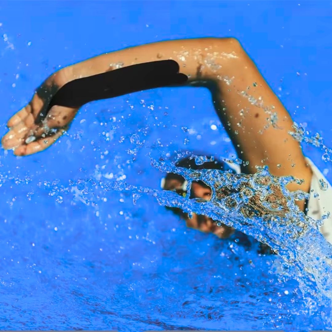 Karpaltunnel und Sehnenscheiden- Entzündung (Tendinitis)