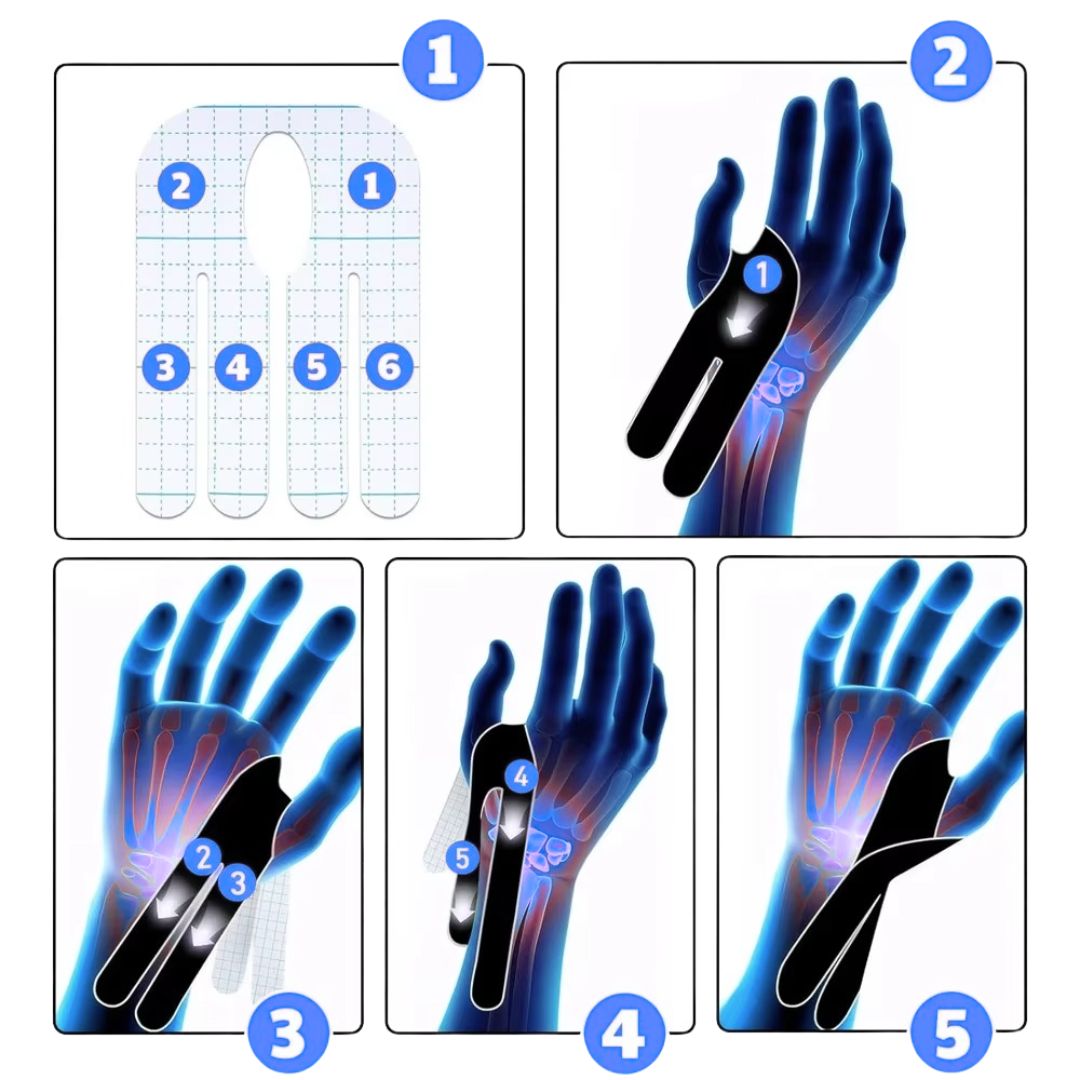 Karpaltunnel und Sehnenscheiden- Entzündung (Tendinitis)