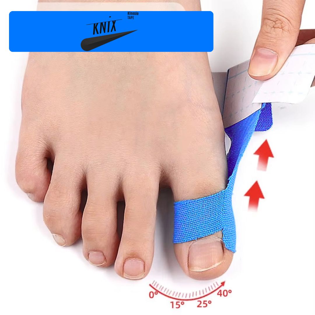 KniX™ | Ballenzeh (Hallux valgus)